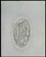 Compacted to Early Blastocyst