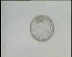 Expanded Blastocyst with clear inner cell mass